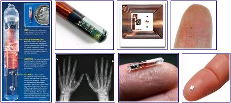 Microchip Implants